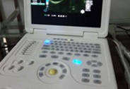 彩超超声检查