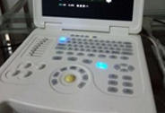 彩超检查